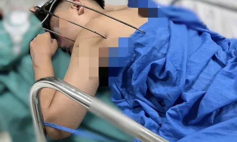 Nam sinh 17 tuổi bị cây đinh ba đâm xuyên tim phổi thoát chết kì diệu