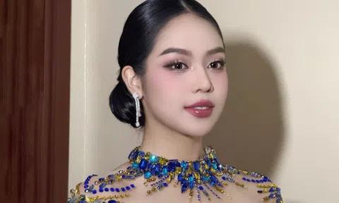 Hoa hậu Thanh Thủy nhập viện ở Indonesia