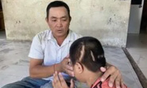 Vụ học sinh lớp 3 bị xe tông tổn thương 90%: Người giao xe có phải chịu trách nhiệm?