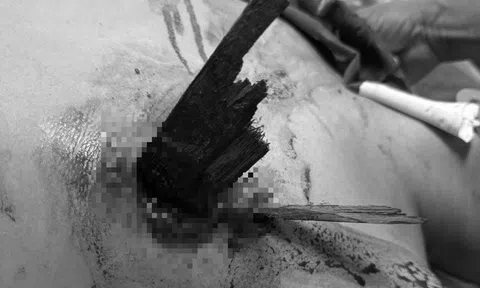 Chạy xe máy mất lái đâm vào hàng rào, nam thanh niên bị thanh gỗ đâm thấu ngực