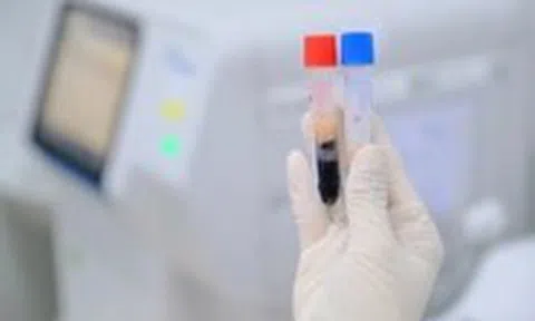 Đi khám sức khỏe phát hiện huyết thanh đục như sữa, nguy cơ đột quỵ cao