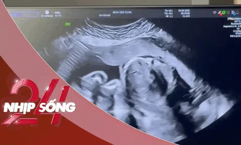 NHỊP SỐNG 24: 30 ngày diệu kỳ bác sĩ Việt cứu thai nhi trong bụng người mẹ Singapore