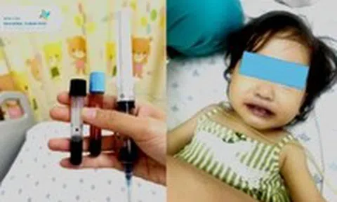 Máu của bé gái chuyển qua màu nâu sau khi ăn canh nấu bằng nước giếng