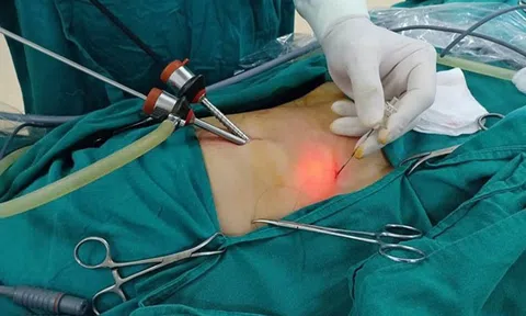 'Thủ phạm giấu mặt' của ung thư đường mật