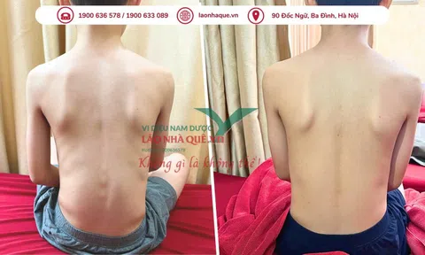 Phương pháp 'Khai thông cột sống' hỗ trợ điều trị đau do thoái hóa khớp tại Lão Nhà Quê
