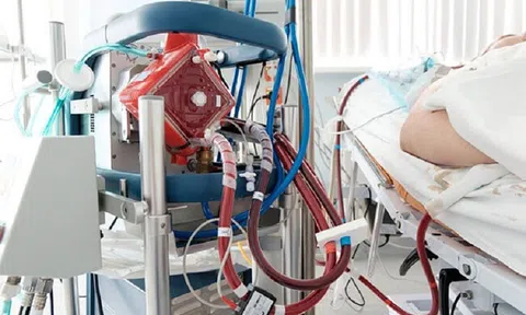 Nữ bệnh nhân nguy kịch sau phẫu thuật phụ khoa do thuyên tắc phổi cấp