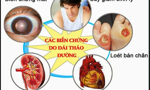 Biến chứng kép tim mạch – võng mạc ở bệnh nhân tiểu đường: Có thể ngăn chặn từ sớm