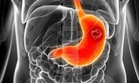 Cách trị viêm loét dạ dày - tá tràng qua bữa ăn