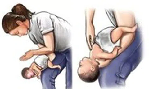 Bé 2 tuổi qua đời do hóc hạt nhãn