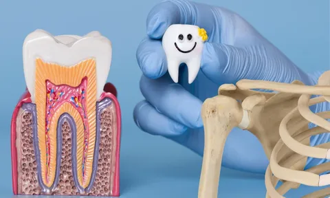 Vì sao răng không được xem là xương?