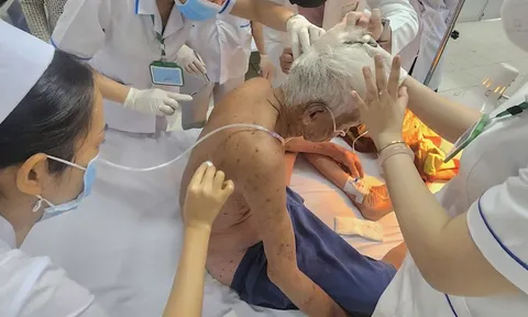 Người đàn ông 74 tuổi bị ong đốt hơn 100 vết được cứu sống kịp thời