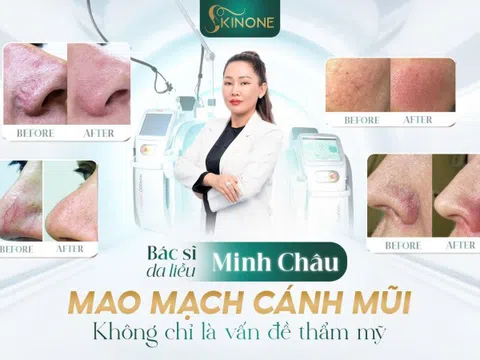 SkinOne - Đột phá trong điều trị mao mạch cánh mũi và da thâm đỏ