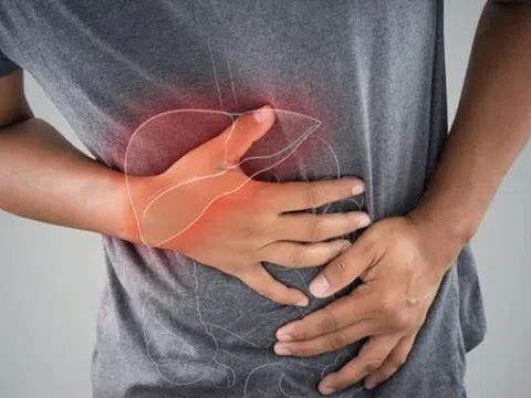 Căn bệnh rất nhanh thành ung thư, thay đổi lối sống 'điều trị' được nhưng nhiều người Việt vẫn thờ ơ