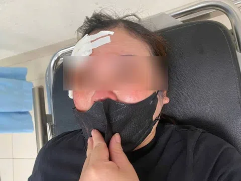 Hà Nội: Một phụ nữ tố bị người đi ô tô dùng dùi cui đập vào đầu vì không tránh đường