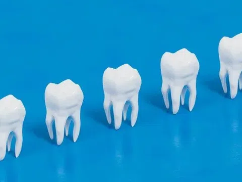 Cấy ghép răng bằng tế bào gốc: Chấm dứt trám răng, đau đớn khi điều trị tủy