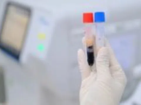 Đi khám sức khỏe phát hiện huyết thanh đục như sữa, nguy cơ đột quỵ cao