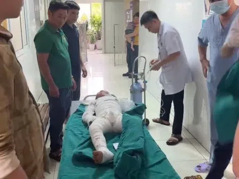 Sử dụng xăng để đốt diệt kiến, hai anh em bỏng nặng