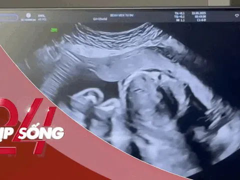 NHỊP SỐNG 24: 30 ngày diệu kỳ bác sĩ Việt cứu thai nhi trong bụng người mẹ Singapore