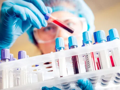 Những lưu ý đặc biệt trước khi xét nghiệm máu để có kết quả chính xác nhất