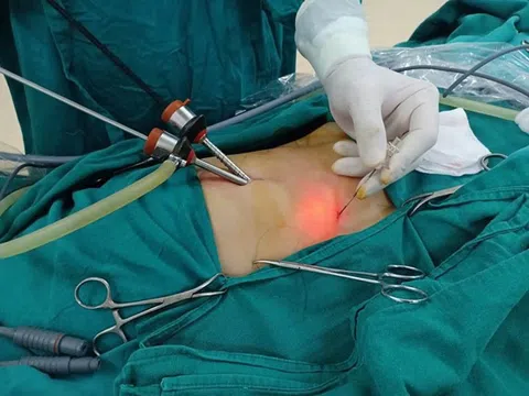 'Thủ phạm giấu mặt' của ung thư đường mật