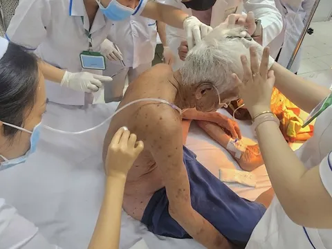 Người đàn ông 74 tuổi bị ong đốt hơn 100 vết được cứu sống kịp thời